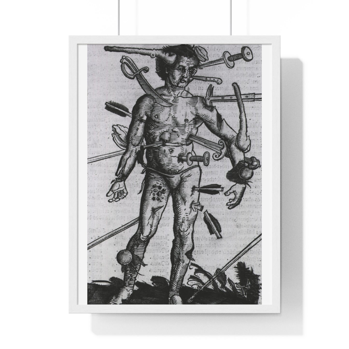 Wound Man (1519) by Hans von Gersdorff from 'Feldtbuch der Wundartzney', from the Original, Framed Print